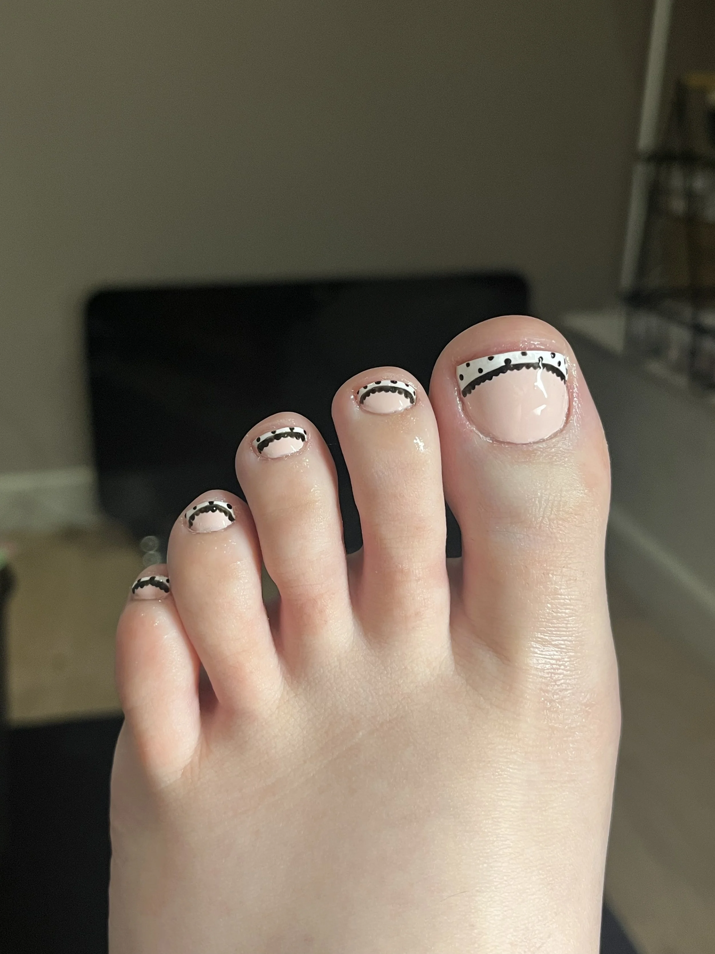 Close-up of a person's hand showing fingernails with black and white nail art designs.