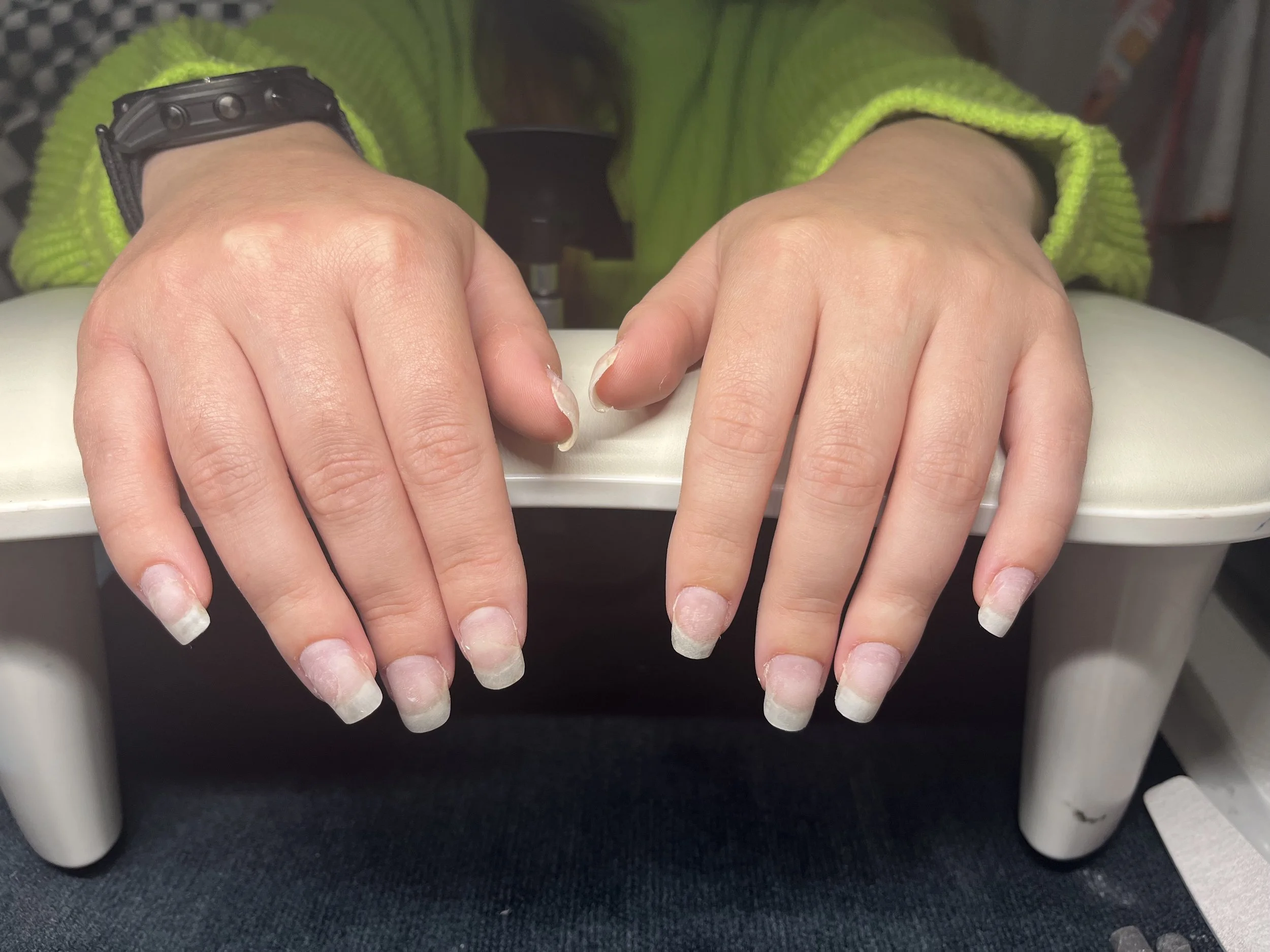 Close-up of a person's hands resting on a white surface, showing natural nails with no polish, and wearing a black watch with a black band on their left wrist. The person is wearing a bright green, fuzzy jacket.