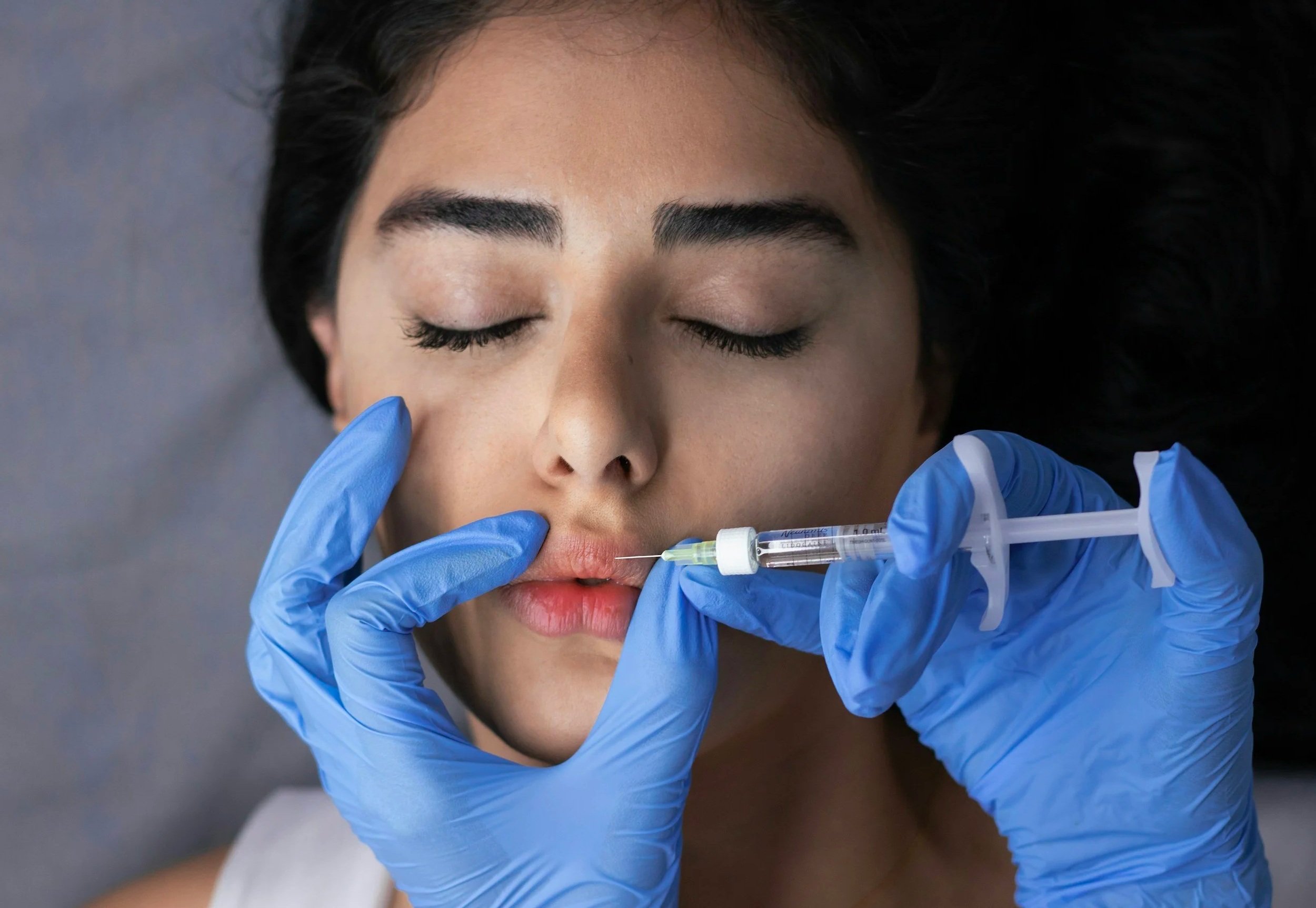 A woman with dark hair and closed eyes receives an injection in her lips from a medical professional wearing blue gloves, holding a syringe.