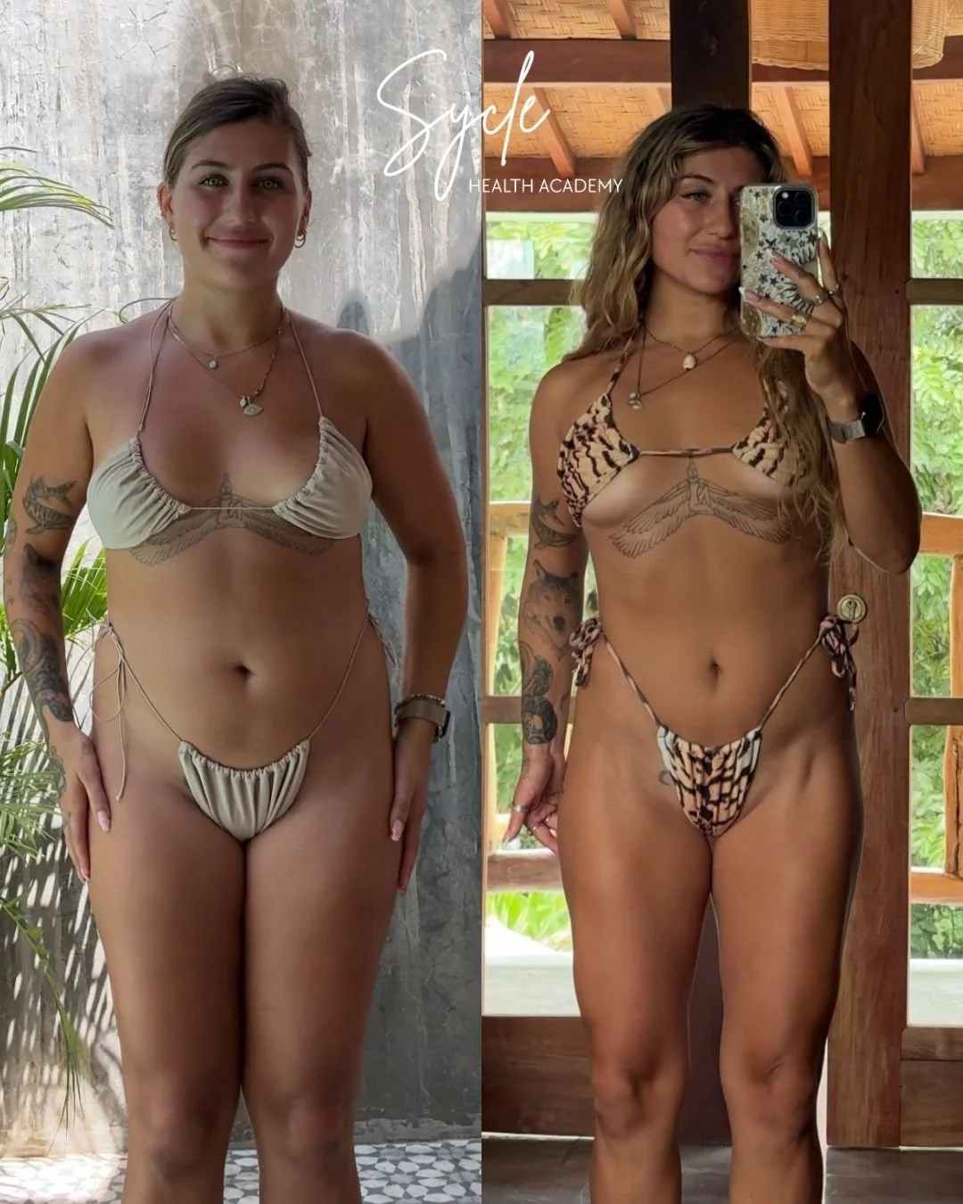 Monique, 29, body recomposition (after ovarian cyst rupture)
