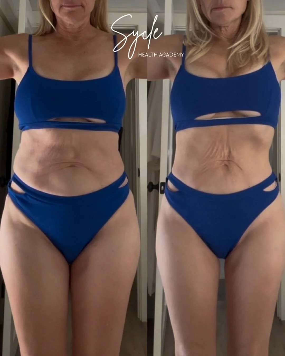 Catherine, 61, lost 11 lbs in 2 months and feels stronger than ever post postmenopause. 
