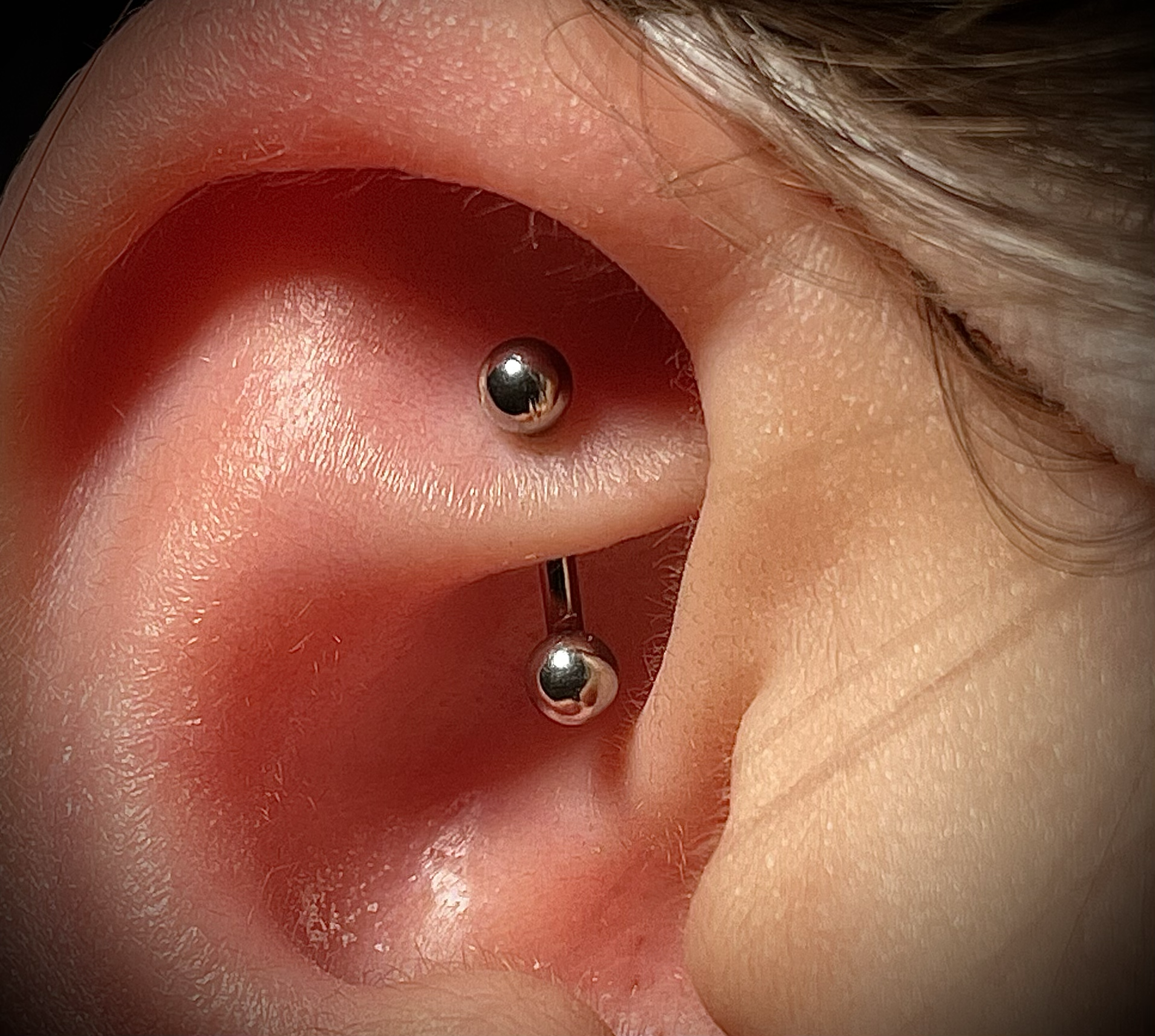 Nahaufnahme eines Bauchnabels mit Piercing und umgebender Haut, einschließlich Haare auf der Haut.