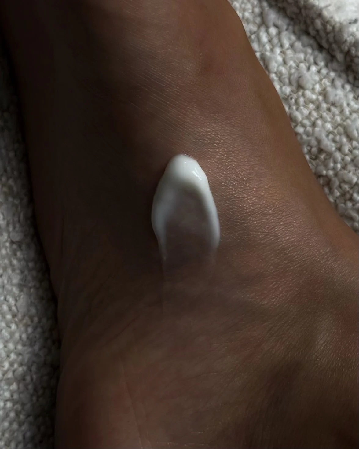 Close-up of foot cream applied to the side of the foot.