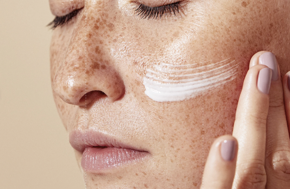 Close-up of a woman's face with freckles applying white facial cream near her eye.