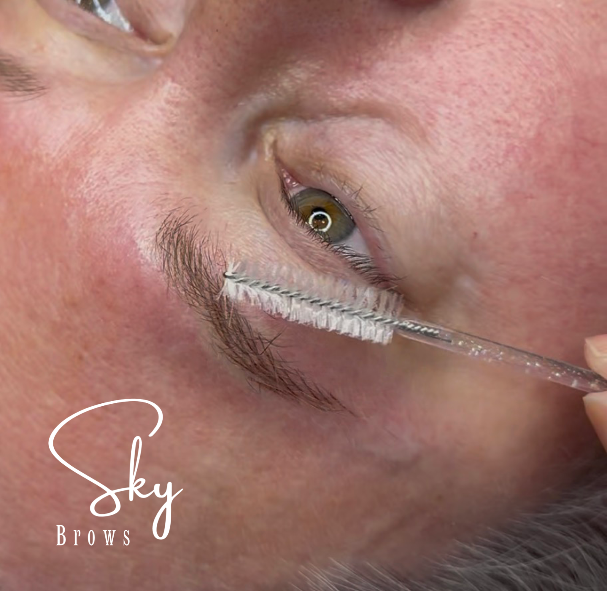 Close-up of a person's face showing their eye, eyebrow, and surrounding skin with a partially visible surgical tool and the text 'Eyebrow Brows' overlaid.