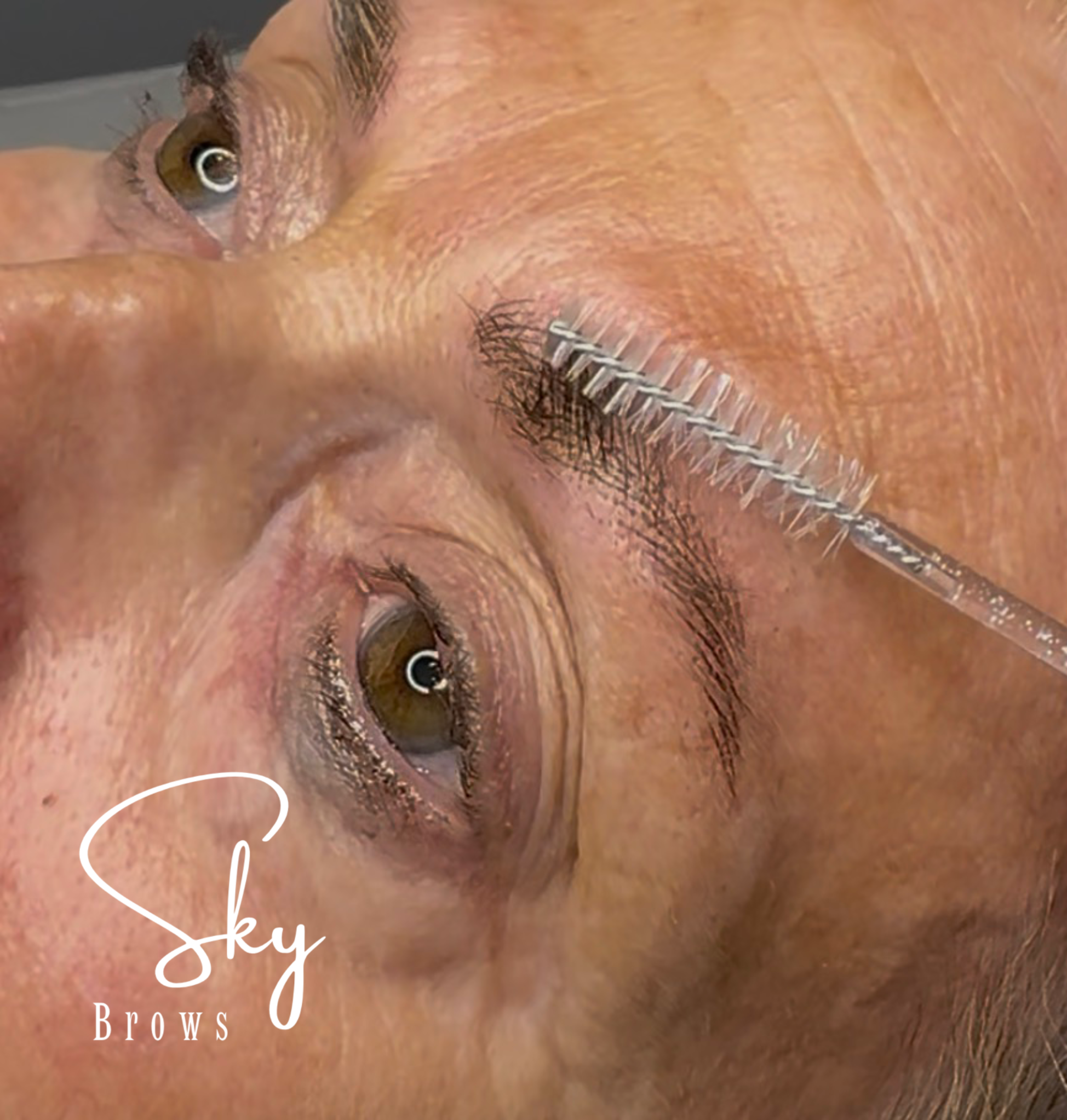 Close-up of a person's eye, eyebrow, and nose, with a medical tool near the person's eyelid, and the words "sky brows" appearing in stylish script at the bottom.