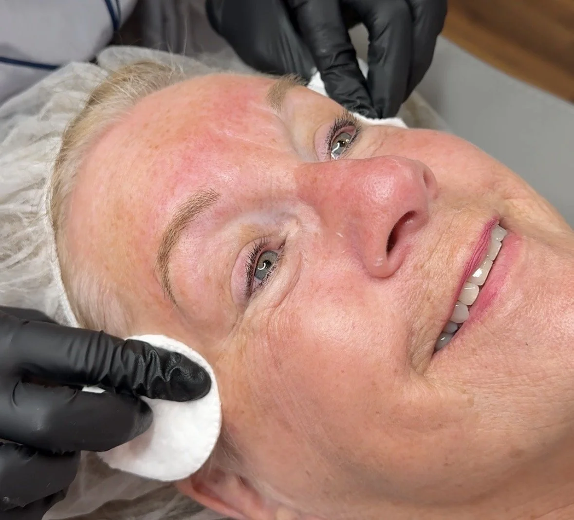 Close-up of a woman receiving a facial treatment, with a professional in black gloves gently cleansing her face with a cotton pad.