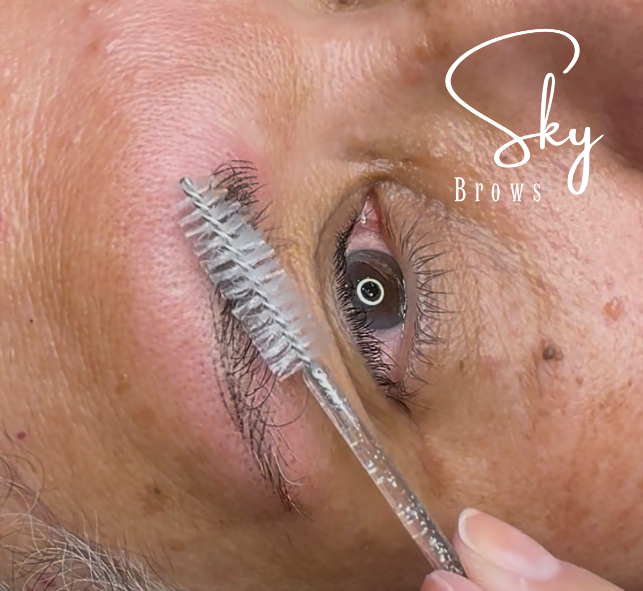 Close-up of a person's forehead with an eyebrow threading procedure in progress, showing a metallic tool near the eyebrow area and a white sticker on the face reading 'Sky Brows'.