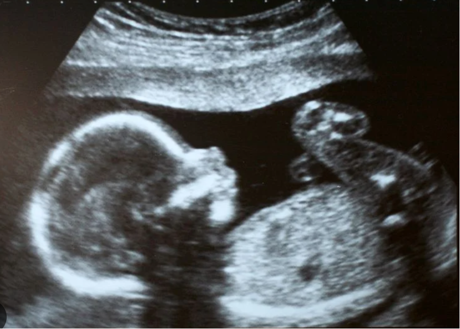 Ultrasound image showing a fetus in the womb.©odoVita