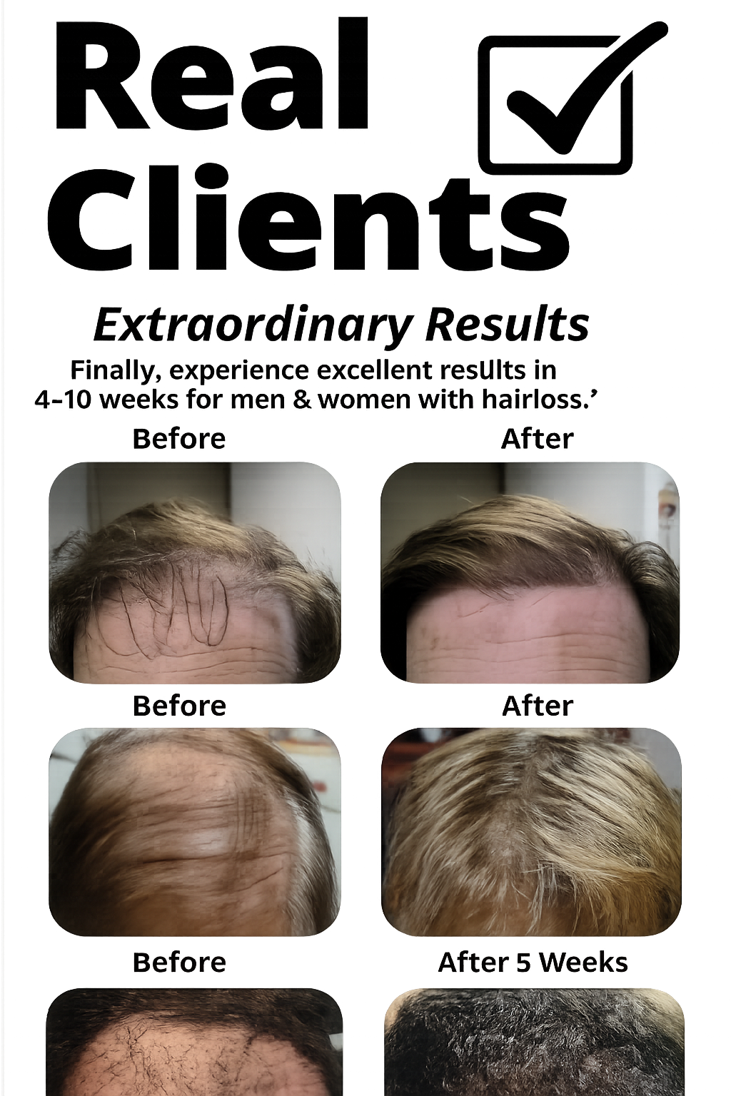 A collage showing before and after images of men's hair growth results from a hair treatment. The top section contains a headline about hair loss treatment, with a subtitle stating it takes about 4 to 6 weeks for visible results. There are three sets of before-and-after photos demonstrating improvements in hair density and coverage for different individuals.