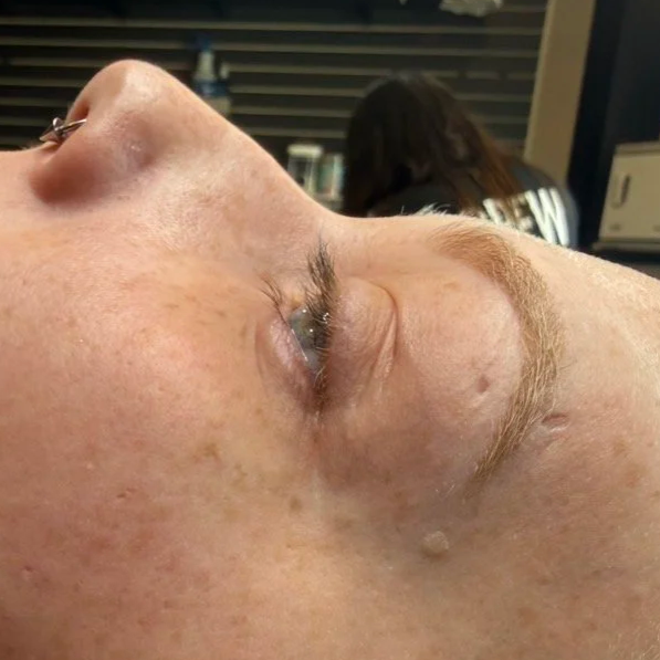before:lash lift