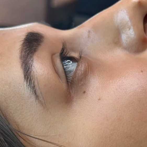 before: lash lift