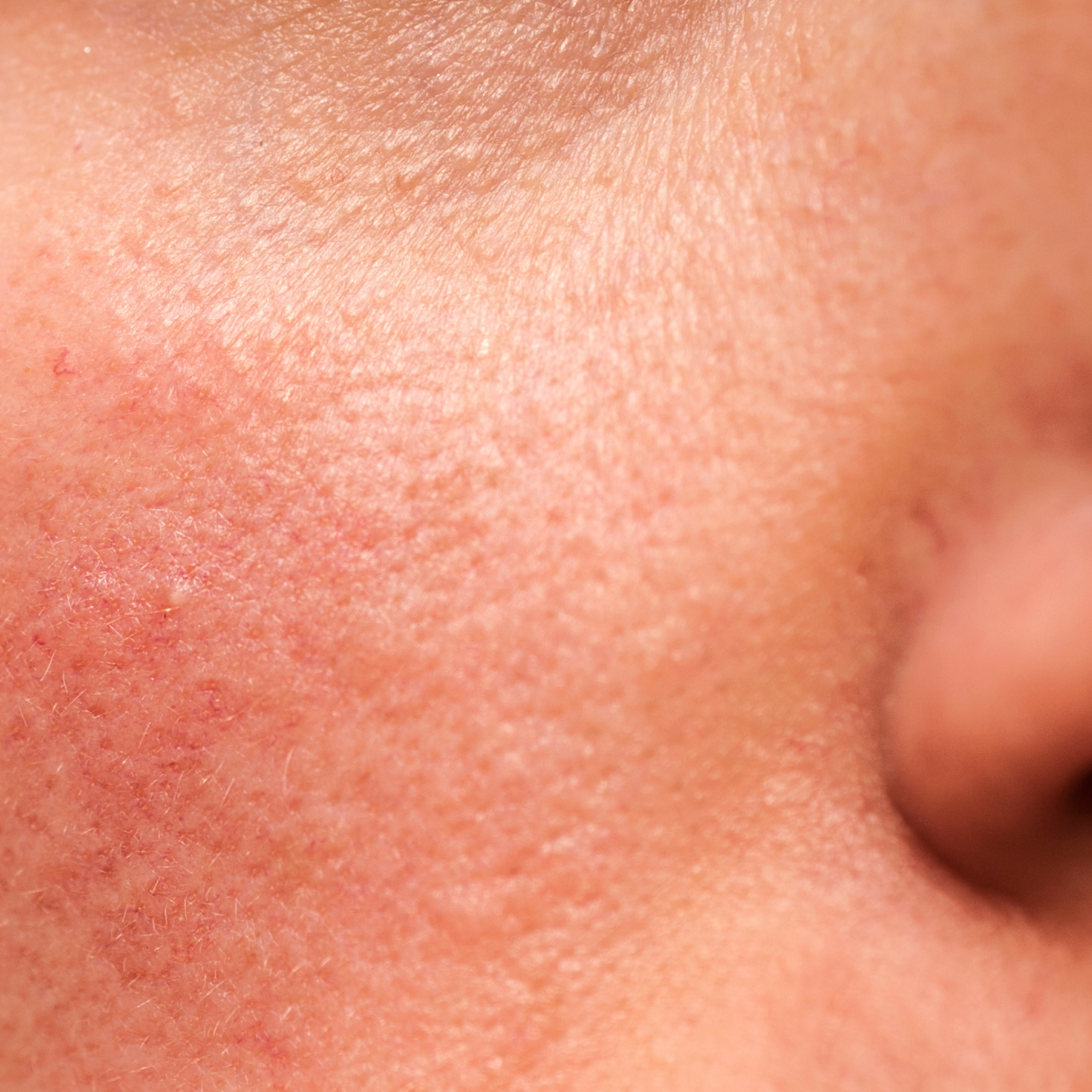 Understanding Your Skin Barrier: The Foundation of Healthy Skin