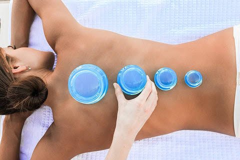 Cupping