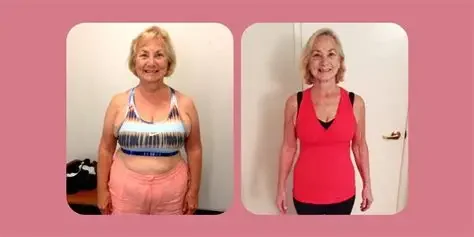 Side-by-side comparison of a woman before and after weight loss, smiling in both images.