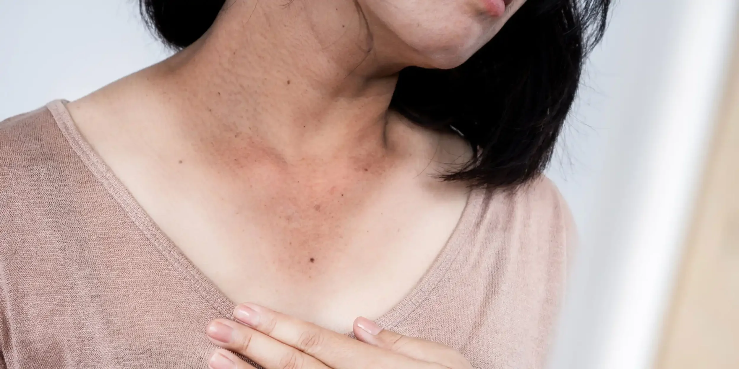Close-up of a woman wearing a pink shirt with her hand on her chest, showing some red skin irritation or rash on her neck.