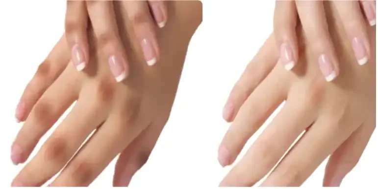 Two side-by-side images of hands with manicured nails, showing a before and after of nail polish removal.