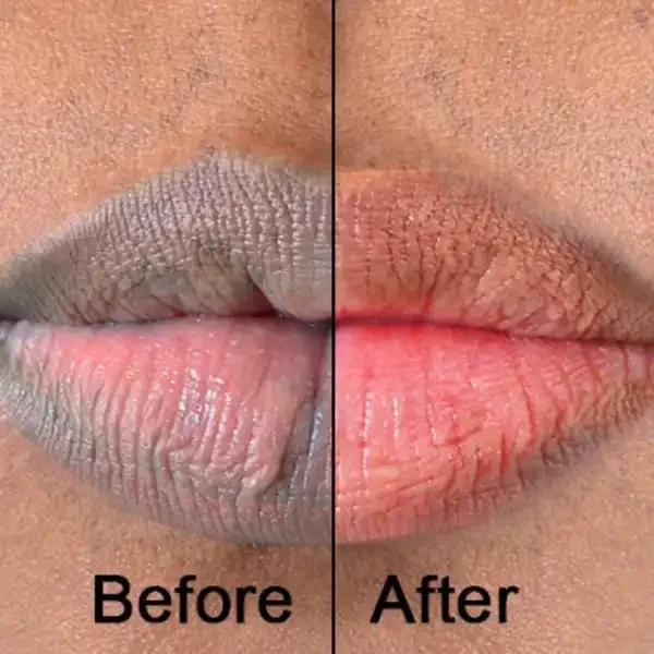 Close-up of lips showing a comparison with the words "Before" and "After". The "Before" side has dry, cracked lips, while the "After" side has smoother, more hydrated lips.