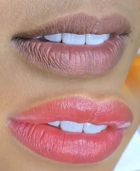 Close-up of a person's lips with lip gloss, showing slightly parted lips revealing teeth.