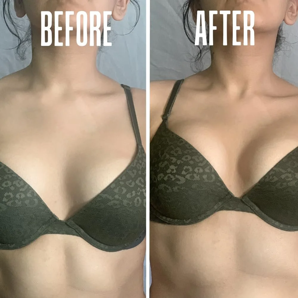 Comparison photo showing a woman's upper torso before and after a breast enhancement. The left side labeled "BEFORE" shows smaller breasts, while the right side labeled "AFTER" shows larger, fuller breasts in the same black bra with leopard print. Both photos focus on the chest area.