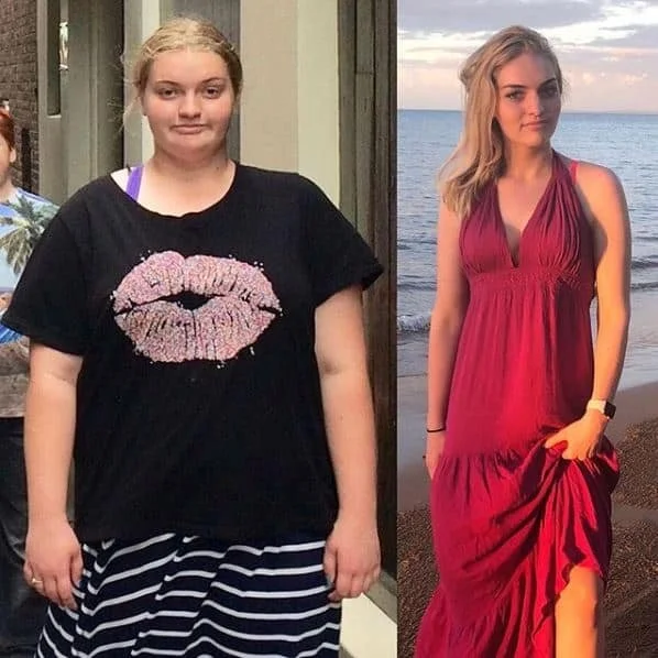 Side-by-side comparison photo of a woman before and after weight loss. On the left, she has a fuller face and is wearing a black t-shirt with a pink lip graphic and striped skirt. On the right, she has a slimmer face and is wearing a red sleeveless dress at the beach during sunset.