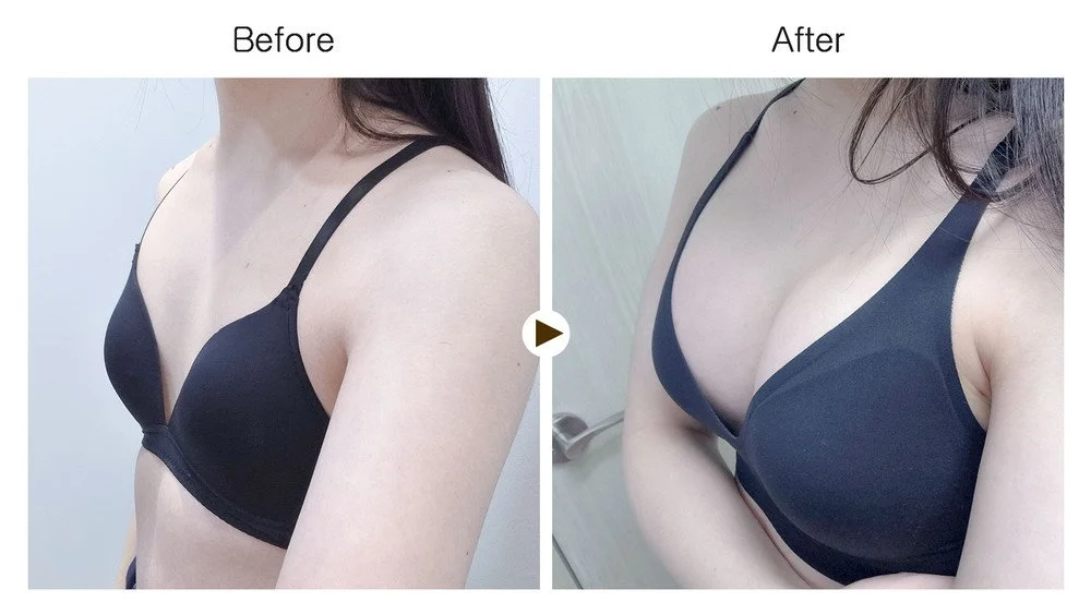 Side-by-side comparison of a woman's chest before and after wearing a black bra, showing a slight lift and change in shape.