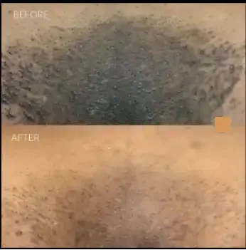 Comparison of a textured surface before and after cleaning, showing cleaner surface in the 'after' section.