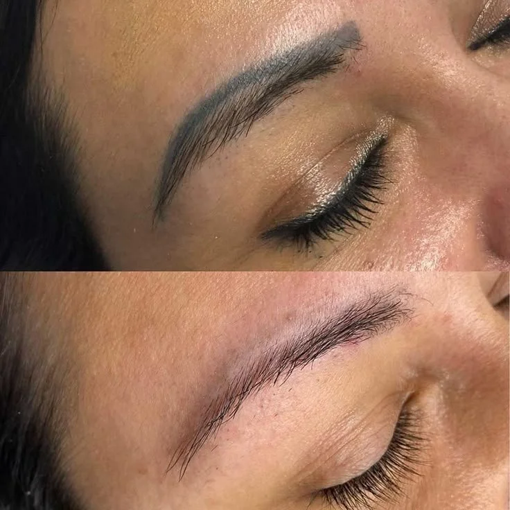 PMU REMOVAL