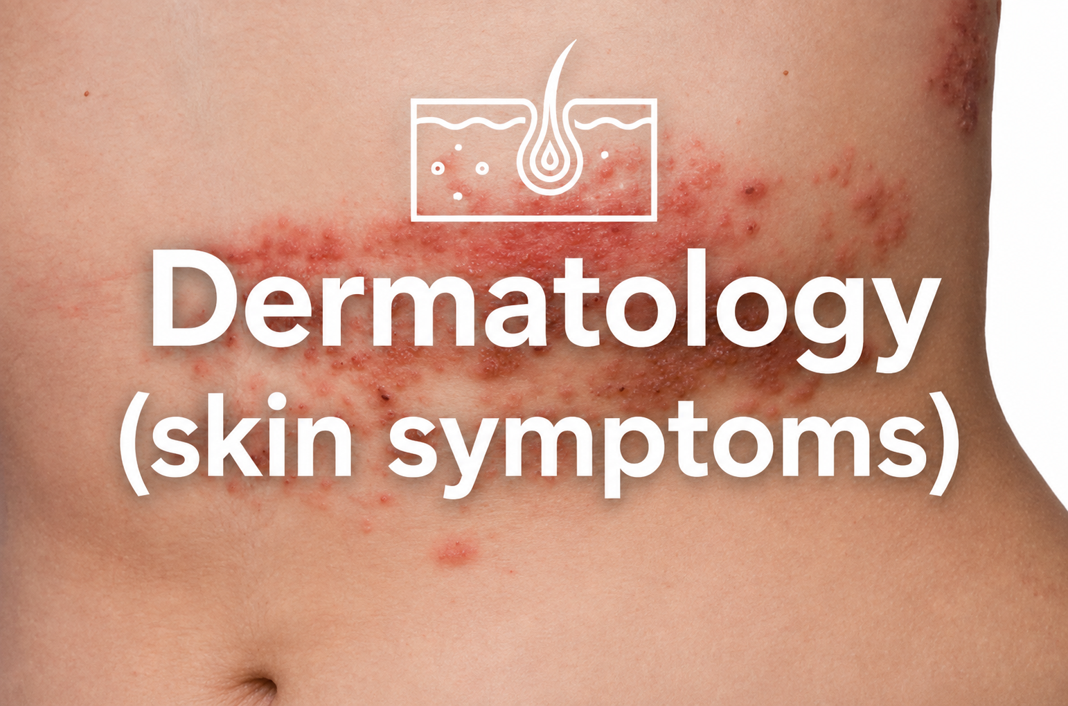 Close-up of skin with redness and inflammation, indicating dermatological skin symptoms.