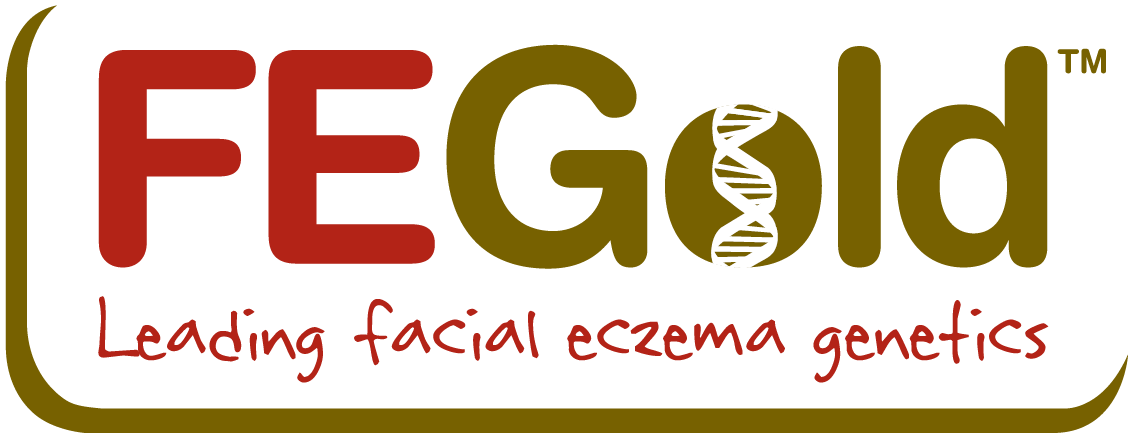 FE Gold logo with tagline "Leading facial eczema genetics," Triple Farm Sheep Genetics King Country New Zealand.  Coopworth and Coopdale rams.