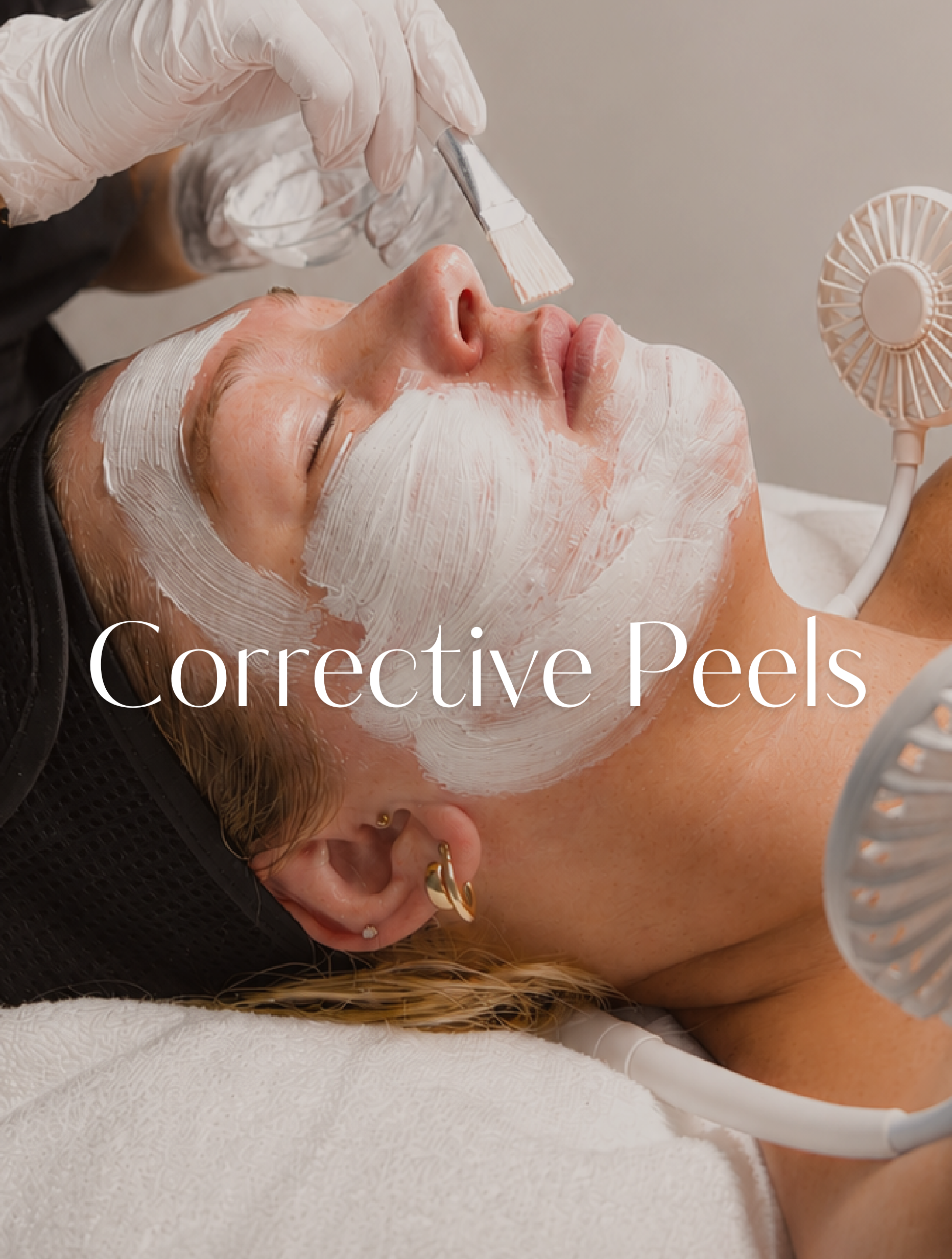 Corrective Peels
