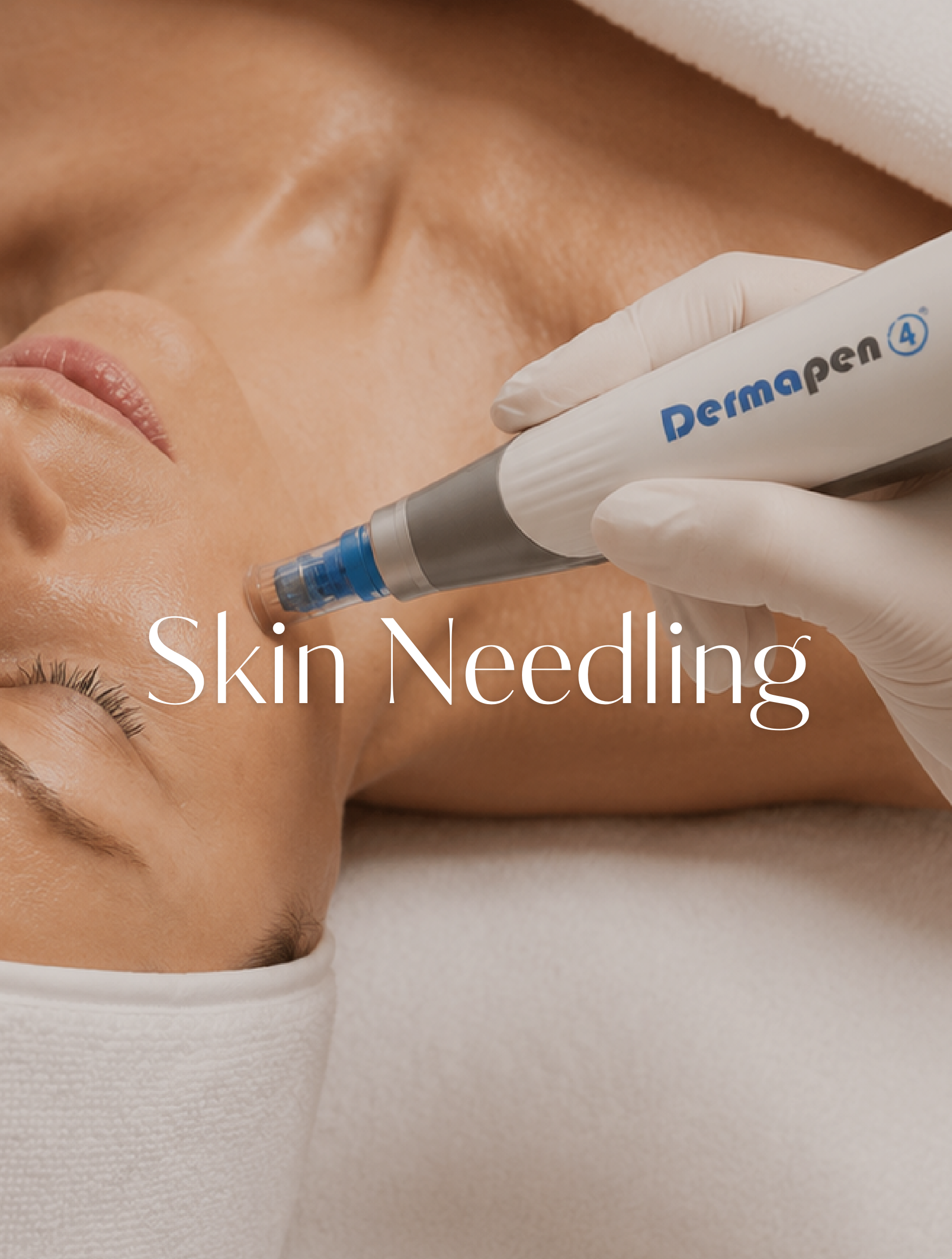 Skin Needling