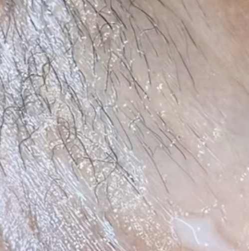 Brazilian — Soft Wax