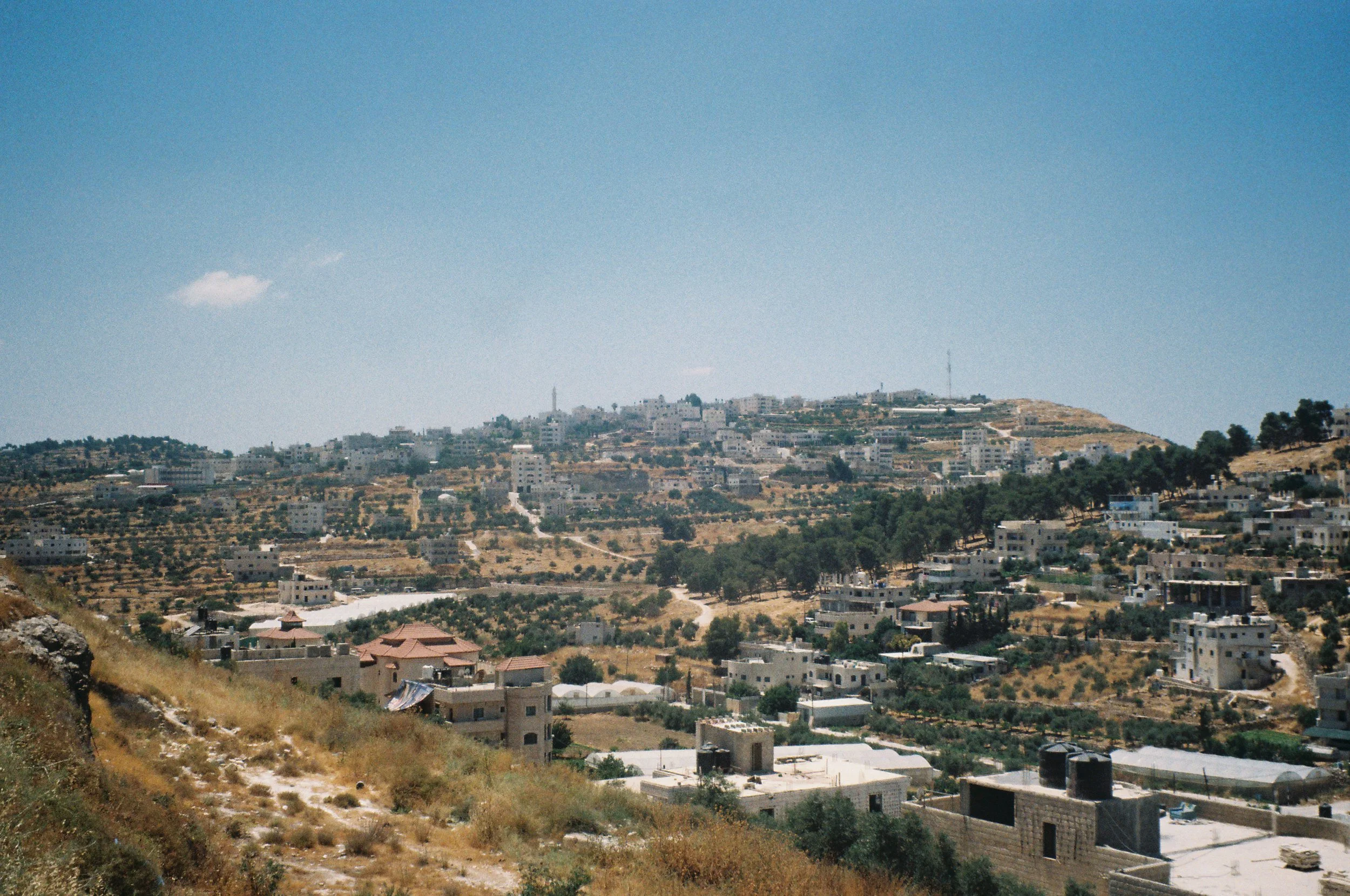 Dura-Area Landscape