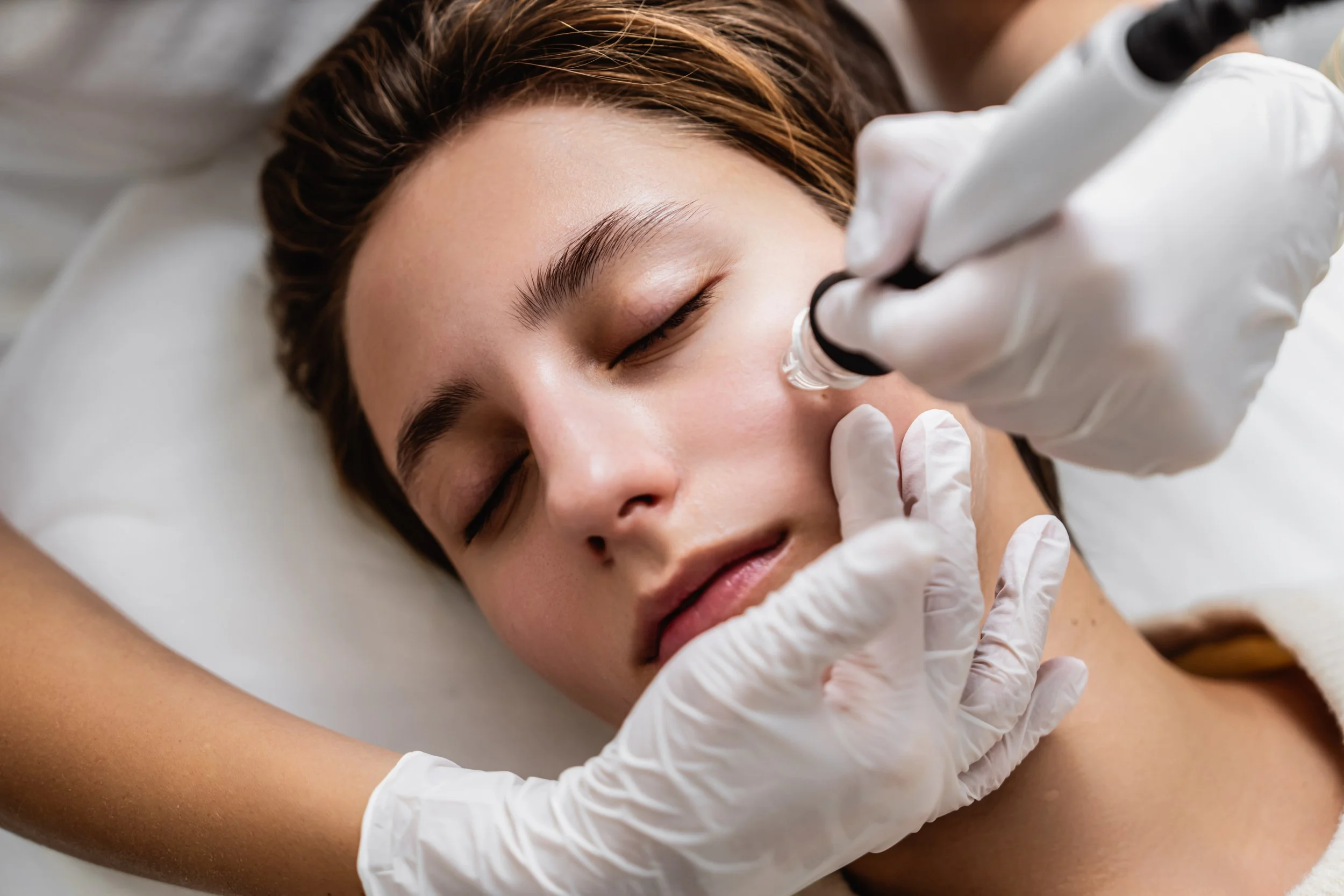 Medspa in Beaver, PA, 15009 Microneedling Near Me