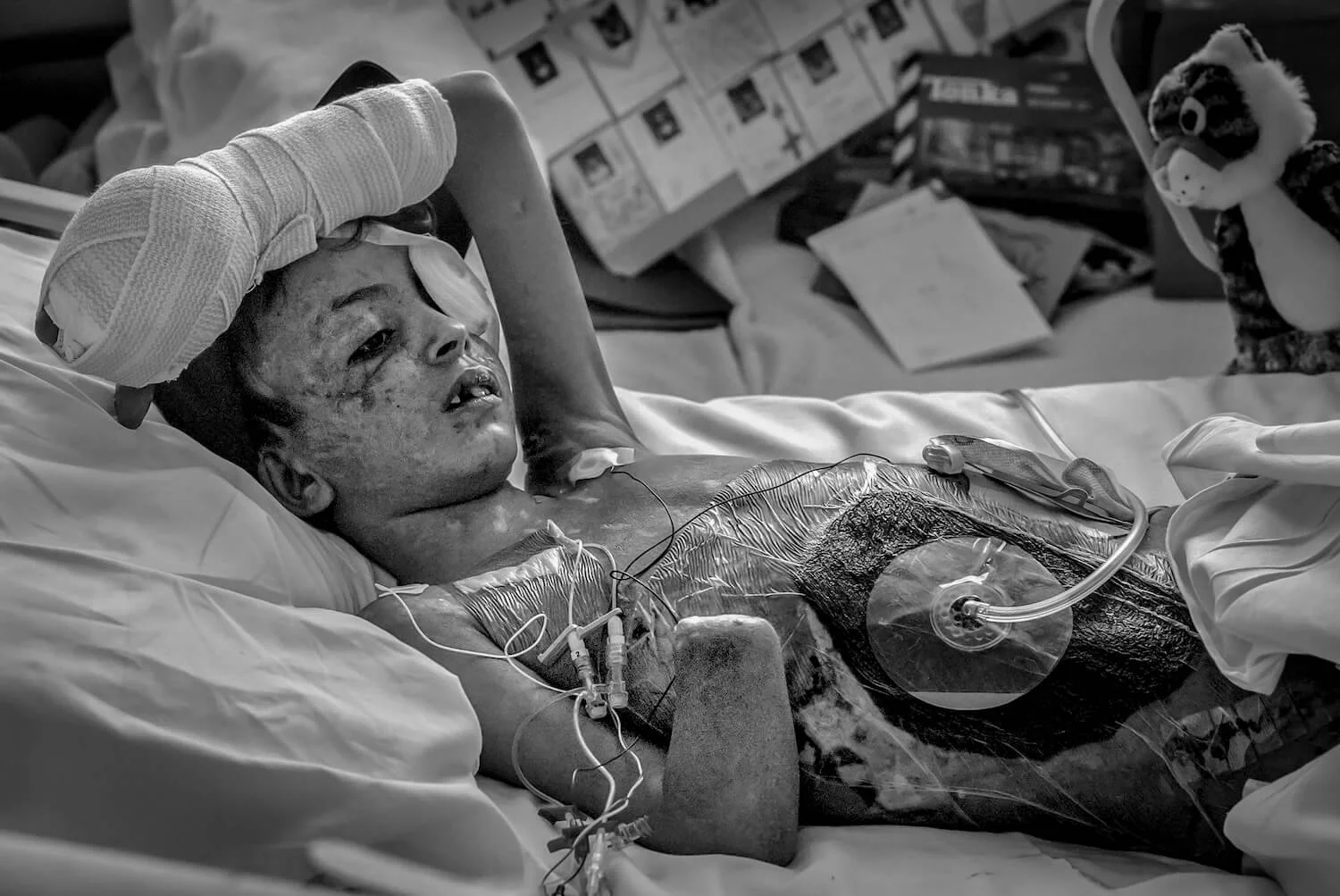 SalehWarInjuredChild_02.jpg