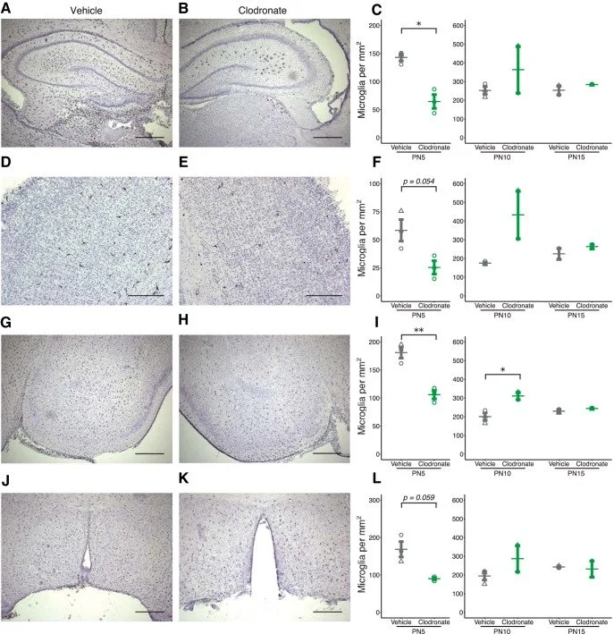 Temporary depletion of microglia during the early postnatal period induces lasting sex-dependent and sex-independent effects on behavior in rats
