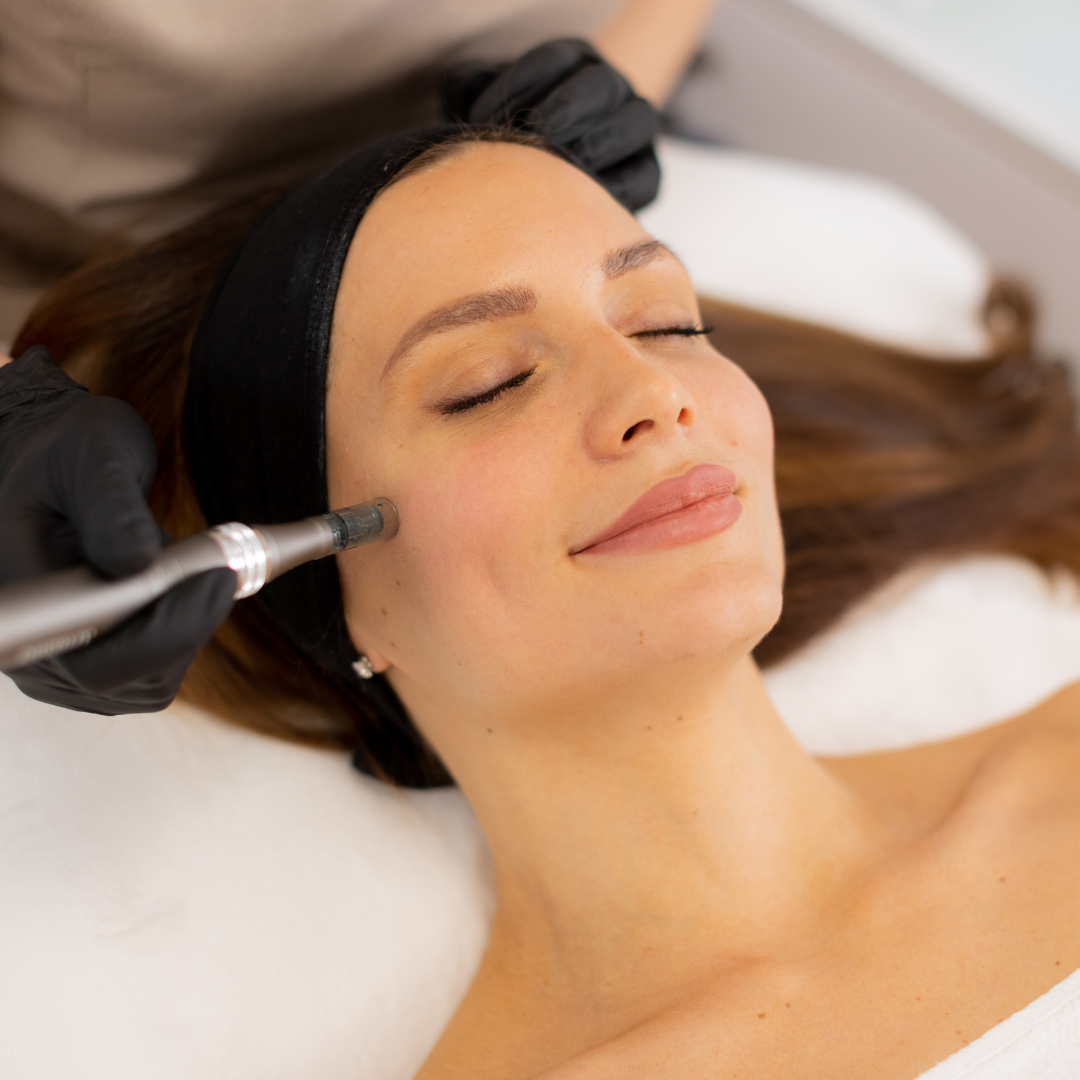 Medspa in Sugar Hill, GA 30518 l Microneedling Near Me