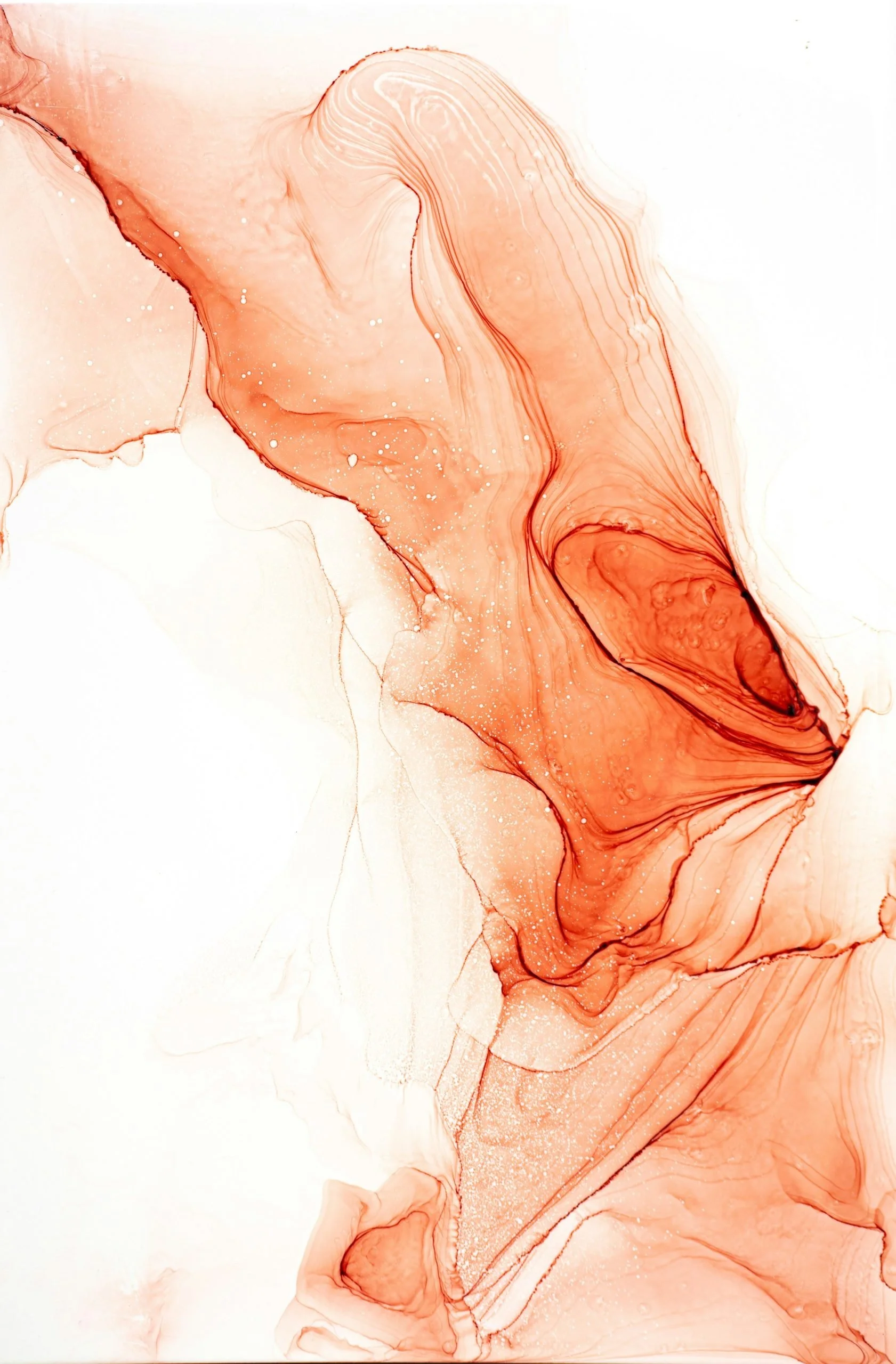 Finding Relief from Interstitial Cystitis: How Pelvic Physical Therapy Can Help