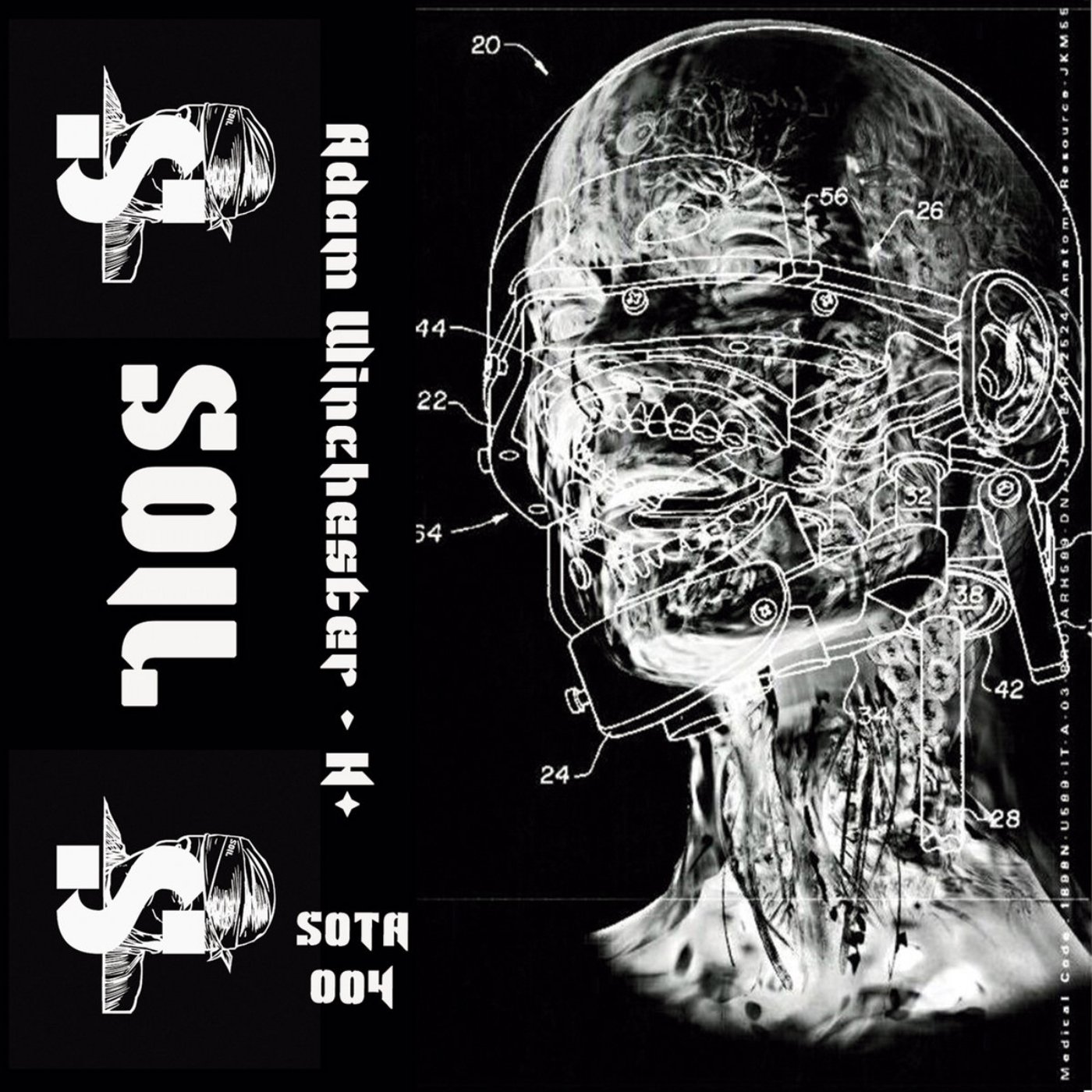 An X-ray image of a human head wearing a helmet, showing detailed anatomy and mechanical components, with technical labels and annotations.