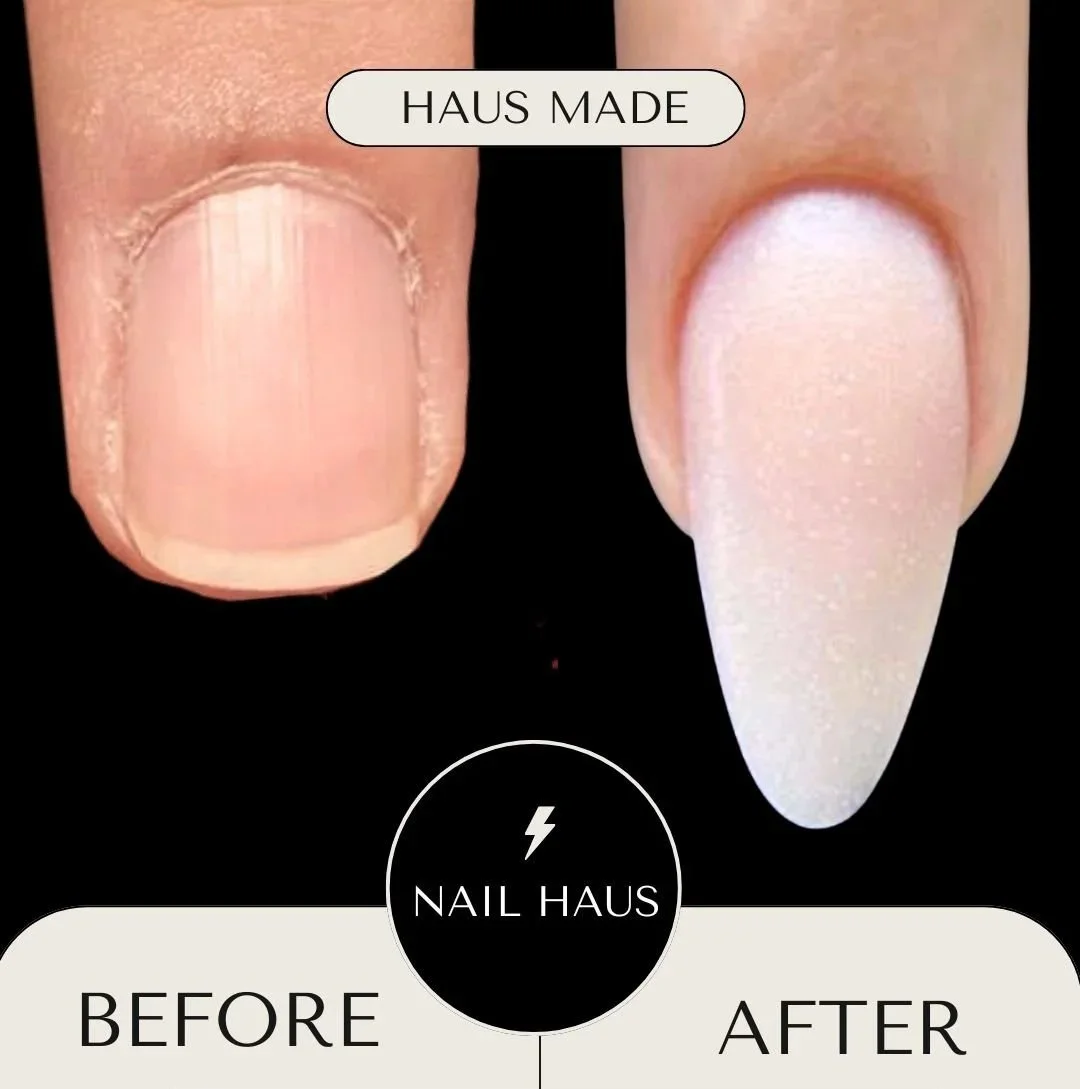 Nail Biter, Anxiety Pickers…WELCOME