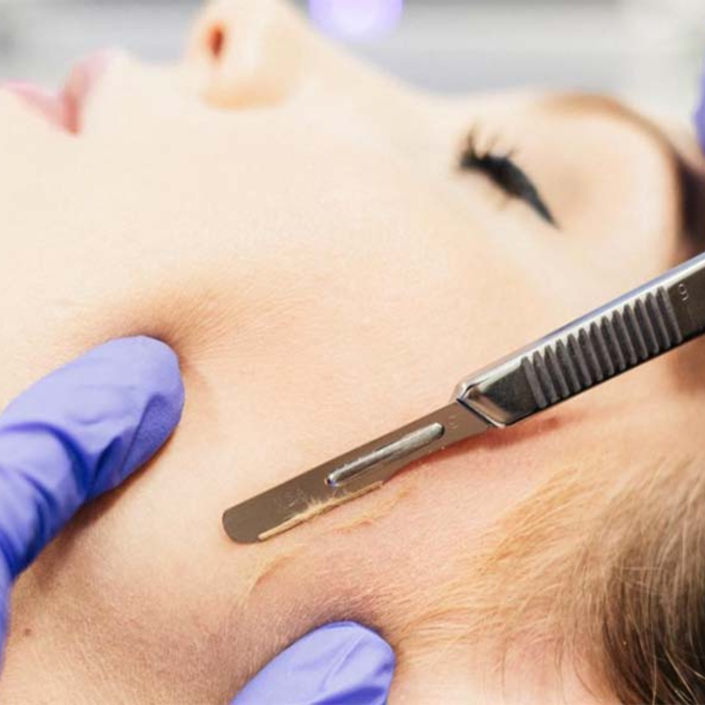 Express Dermaplane