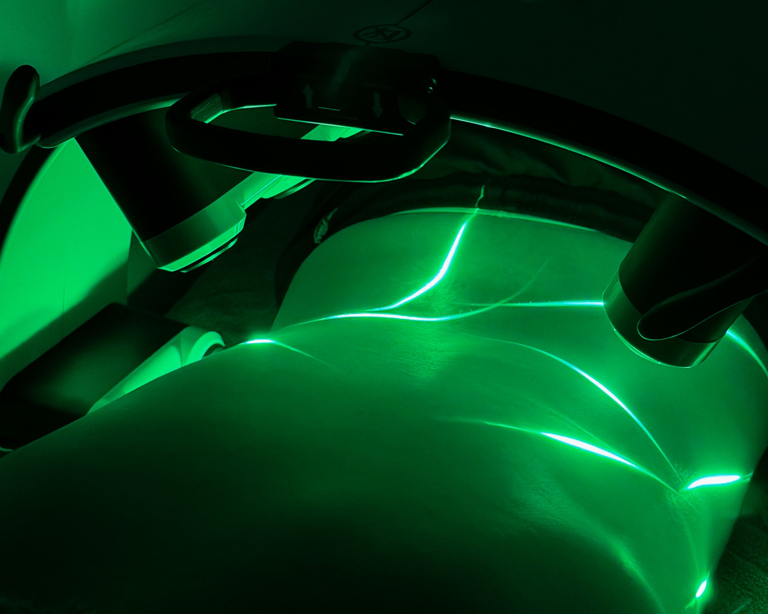 Emerald Laser treatment at Verde Laser Clinic with a client lying face down during non-invasive body circumference reduction therapy.