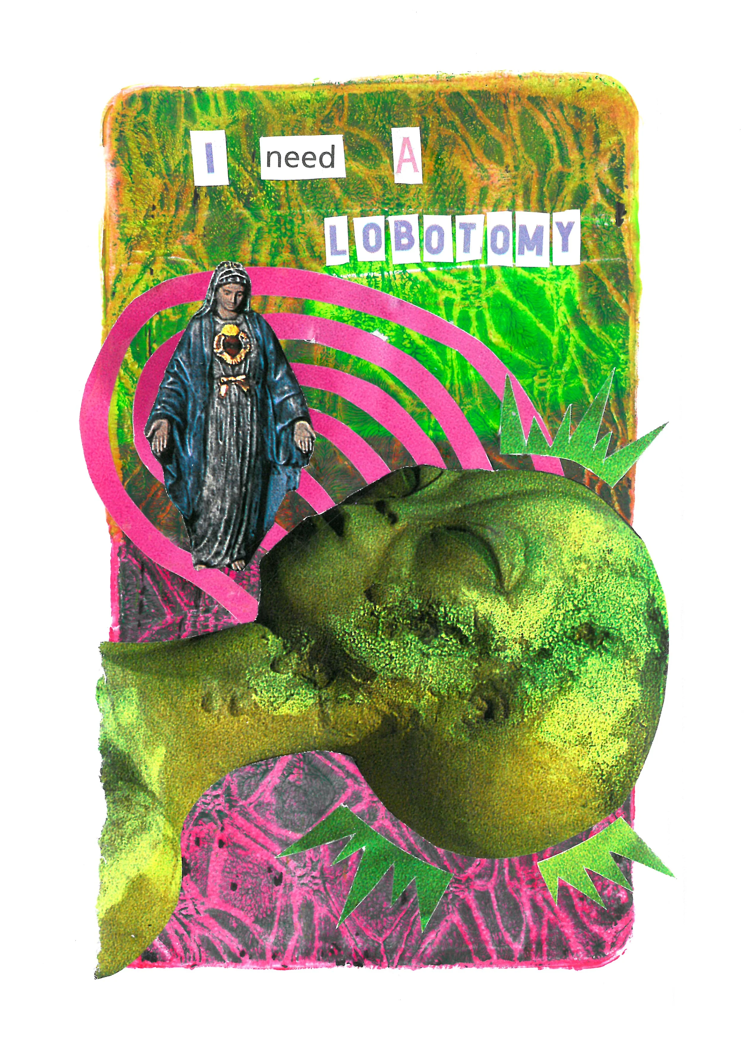 Lobotomy