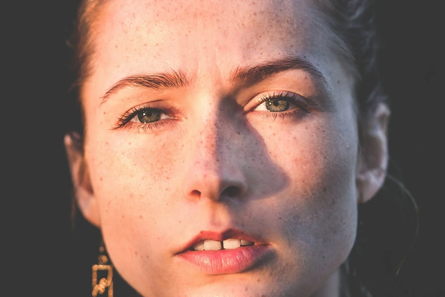 A Cosmetic Doctor On How To Treat Pigmentation With Laser Therapy