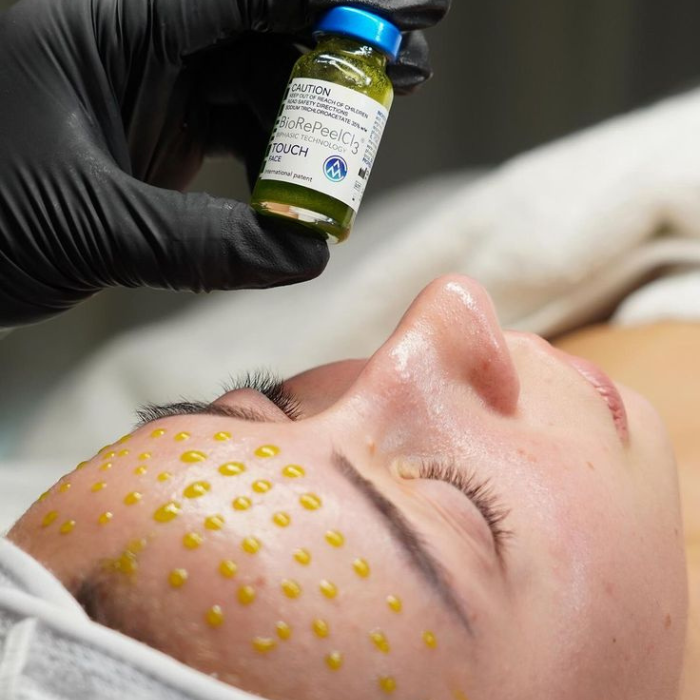 A person laying down with their eyes closed as a gloved hand holds a small vial of greenish liquid above their forehead. The person's forehead has yellow dots, possibly a skincare treatment or diagnostic application.