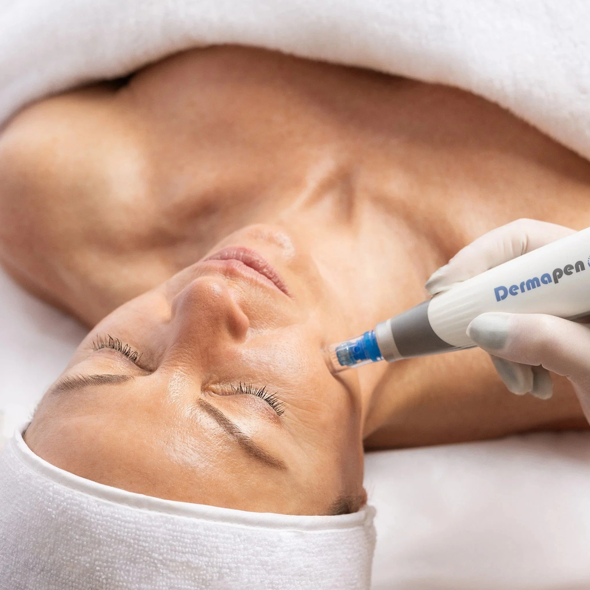 Close-up of a person's face, lying on a white surface, with a gloved hand holding a syringe near their cheek, suggesting a medical or cosmetic procedure.