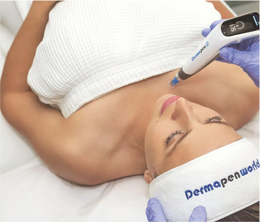 A woman lying on a treatment bed with her eyes closed, receiving a cosmetic procedure on her cheek using a Derma pen device, wearing a headband and a white towel across her chest.