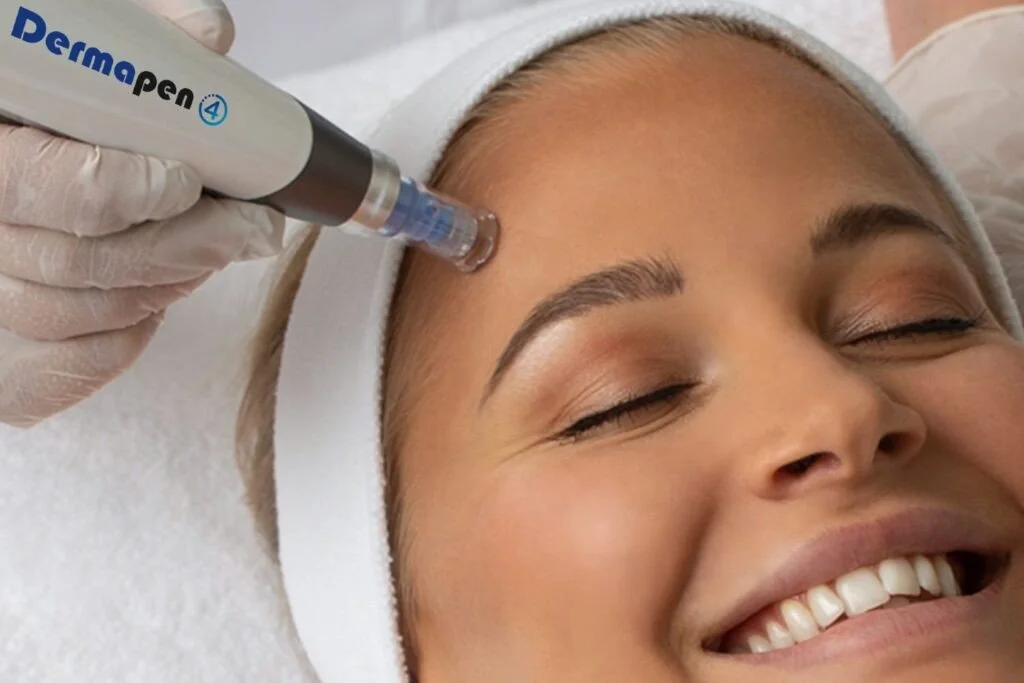 A woman receives a cosmetic treatment on her forehead with a DermaPen device in a spa or dermatology clinic setting.