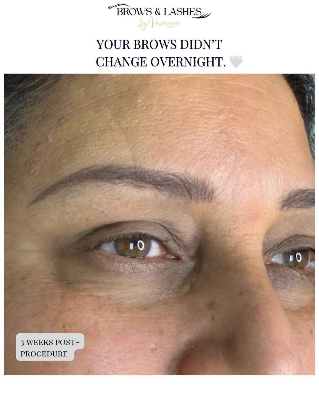 YOUR BROWS DIDN&rsquo;T CHANGE OVERNIGHT. 🤍

Most women don&rsquo;t notice their brows changing until one day they look back at an old photo.

The tails become thinner.

Small gaps appear.

And makeup takes a little longer each morning.

It doesn&rs